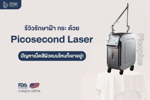 รีวิวรักษาฝ้า กระ ด้วย Picosecond Laser ปัญหาเม็ดสีผิวแบบไหนก็เอาอยู่