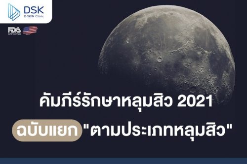 คัมภีร์รักษาหลุมสิว 2021 ฉบับแยกตาม “ประเภทหลุมสิว”