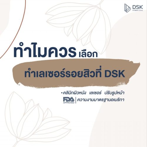 รวมทุกสิ่งที่คุณควรรู้เกี่ยวกับ “เลเซอร์รอยสิว”