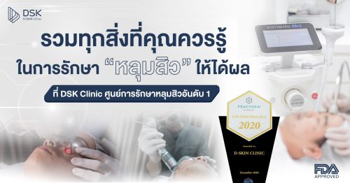 รักษาหลุมสิวให้ได้ผล ที่ DSK Acne Scar Excellence Center
