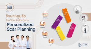 Personalized Scar Planning รักษาหลุมสิวให้หาย ต้องวางแผนเฉพาะบุคคล