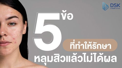 5 ปัจจัย ทำไมรักษาหลุมสิวเท่าไหร่ก็ไม่ได้ผล?