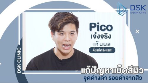 Picosecond Laser เลเซอร์ย้อนวัยผิวเรียบเนียน และรักษาฝ้ากระรอยดำในหนึ่งเดียว