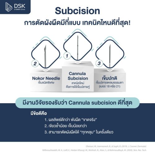 Subcision มีกี่แบบ เทคนิคไหนดีที่สุด!