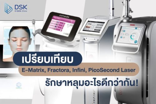 เปรียบเทียบ E-Matrix, Fractora, Infini, Picosecond Laser