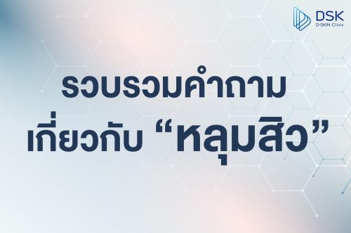 คำถามที่พบบ่อยเกี่ยวกับ ”หลุมสิว “
