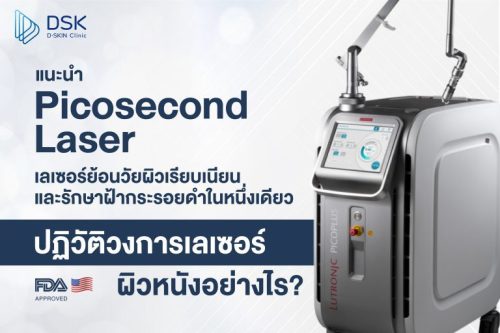 ทำไม Picosecond Laser จึงเป็น “เลเซอร์ที่ดีที่สุด” สำหรับฝ้า กระ