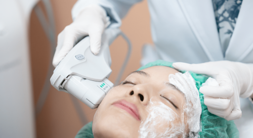 Ulthera SPT อัลเทอร่ารุ่นใหม่ อัพเกรดความยกกระชับ