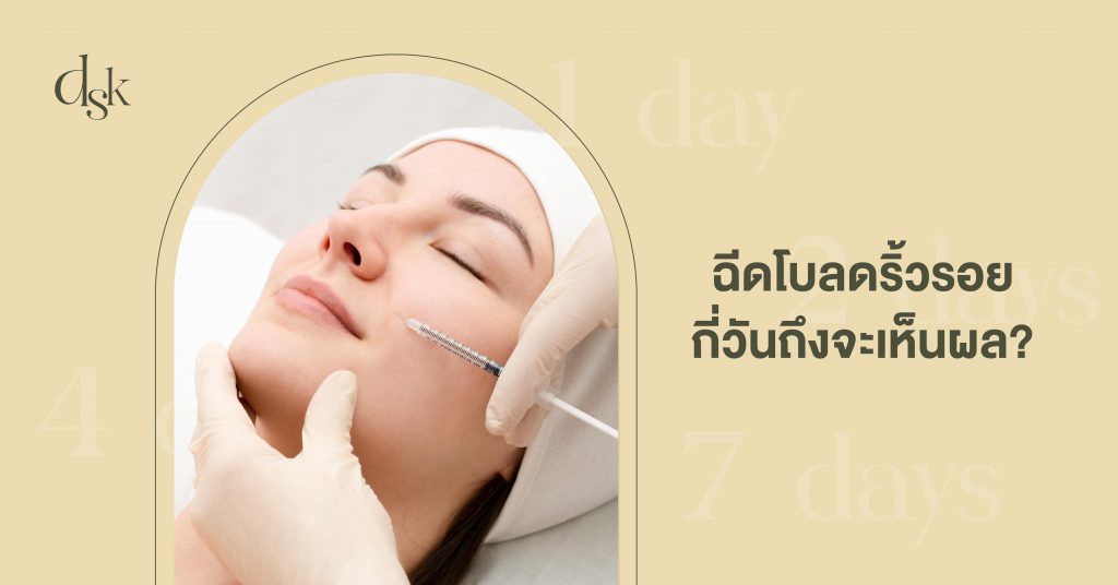 ฉีดโบลดริ้วรอยกี่วันถึงจะเห็นผล?
