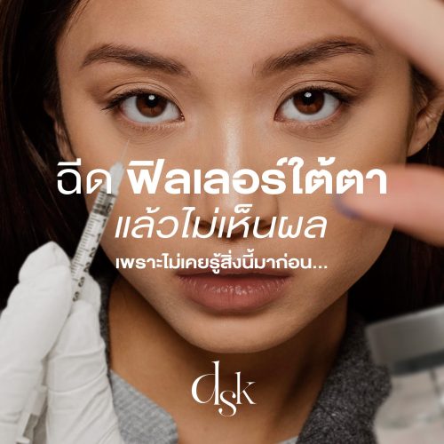 ฉีดฟิลเลอร์ใต้ตา แล้วไม่เห็นผล เพราะไม่เคยรู้สิ่งนี้มาก่อน…