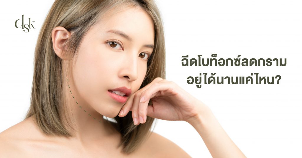 ฉีดโบท็อกซ์ลดกราม อยู่ได้นานแค่ไหน ?