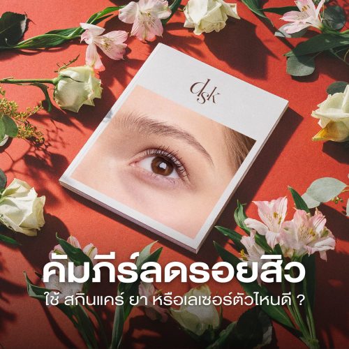 คัมภีร์วิธีลดรอยสิว สกินแคร์ หรือเลเซอร์ ?