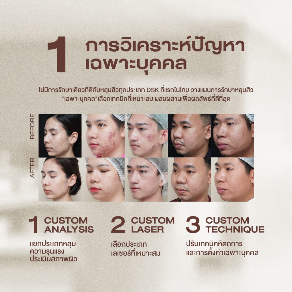 วางแผนการรักษา “เฉพาะบุคคล”