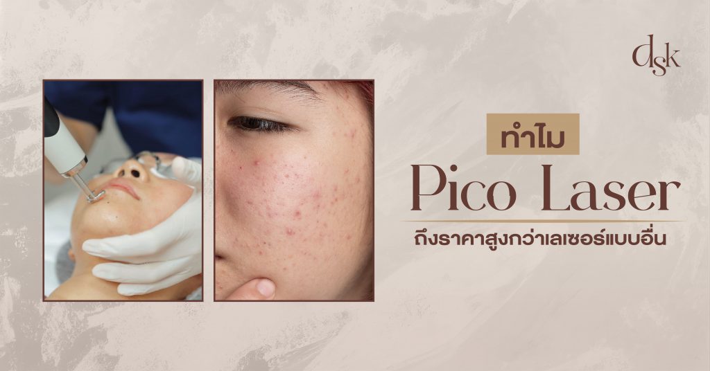 ทำไม Pico laser ถึงราคาสูงกว่าเลเซอร์แบบอื่น