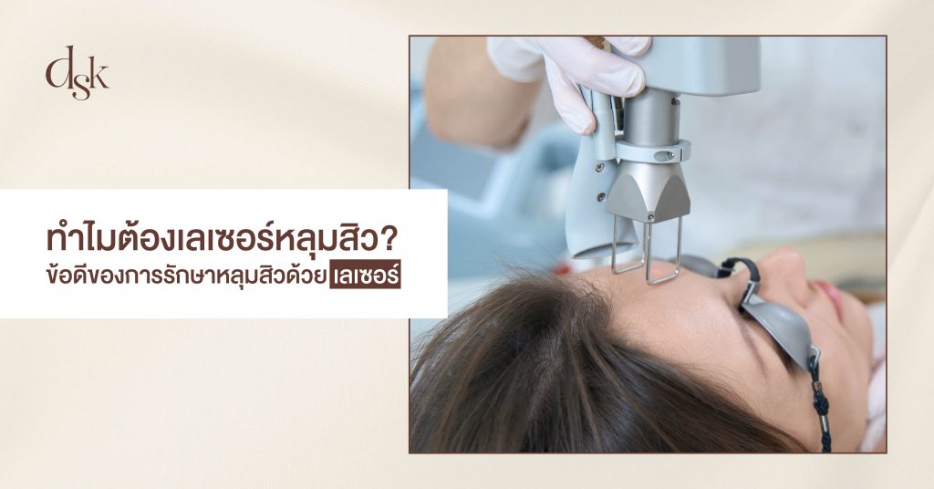 ทำไมต้องเลเซอร์หลุมสิว ข้อดีของการรักษาหลุมสิวด้วยเลเซอร์ ?