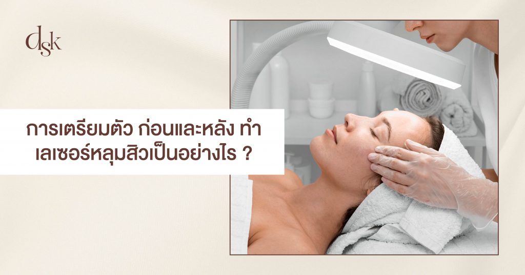 การเตรียมตัวก่อนและหลังทำเลเซอร์หลุมสิวเป็นอย่างไร