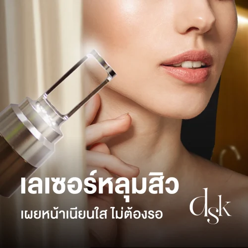 เลเซอร์หลุมสิว เผยหน้าเนียนใส ไม่ต้องรอ