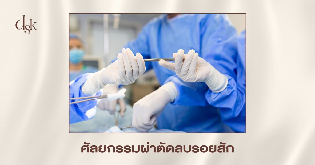 ศัลยกรรมผ่าตัดลบรอยสัก