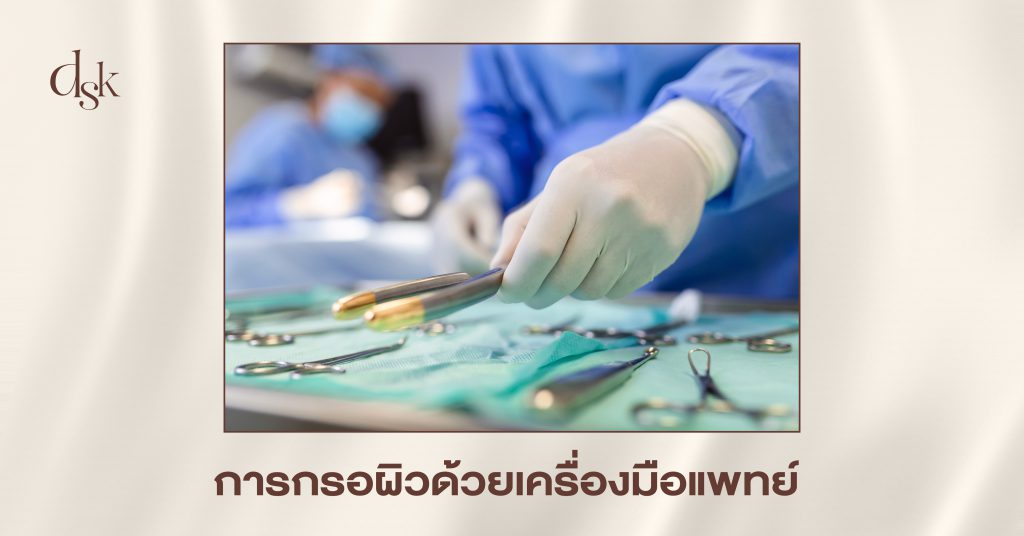 การกรอผิวด้วยเครื่องมือแพทย์