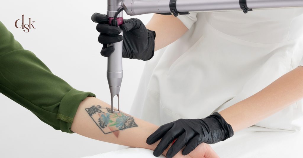 ทำไมต้องลบรอยสักด้วย Picosecond Laser