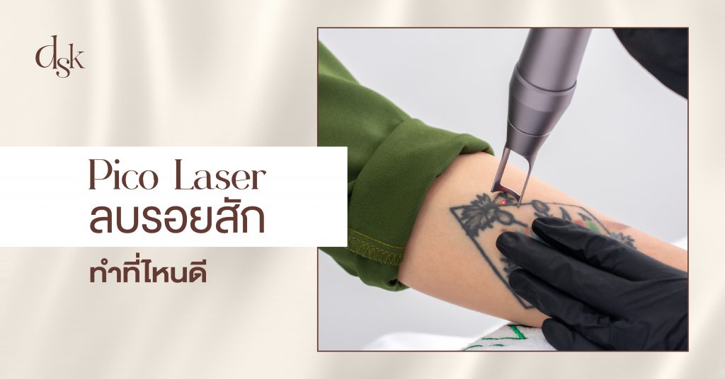 ทำไมต้องลบรอยสักด้วย Picosecond Laser