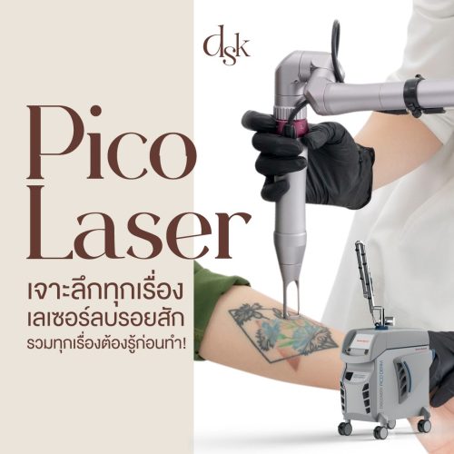 เจาะลึกทุกเรื่อง เลเซอร์ลบรอยสัก รวมทุกเรื่องต้องรู้ก่อนทำ!