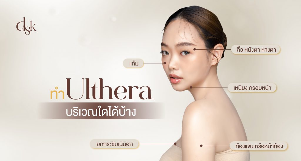 ทำ Ulthera บริเวณใดได้บ้าง