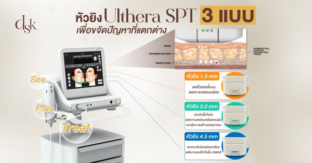 หัวยิง Ulthera SPT 3 แบบ เพื่อขจัดปัญหาที่แตกต่าง
