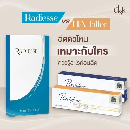 Radiesse VS HA Filler ฉีดตัวไหน ราคาเท่าไหร่ เหมาะกับใคร ควรรู้อะไรก่อนฉีด
