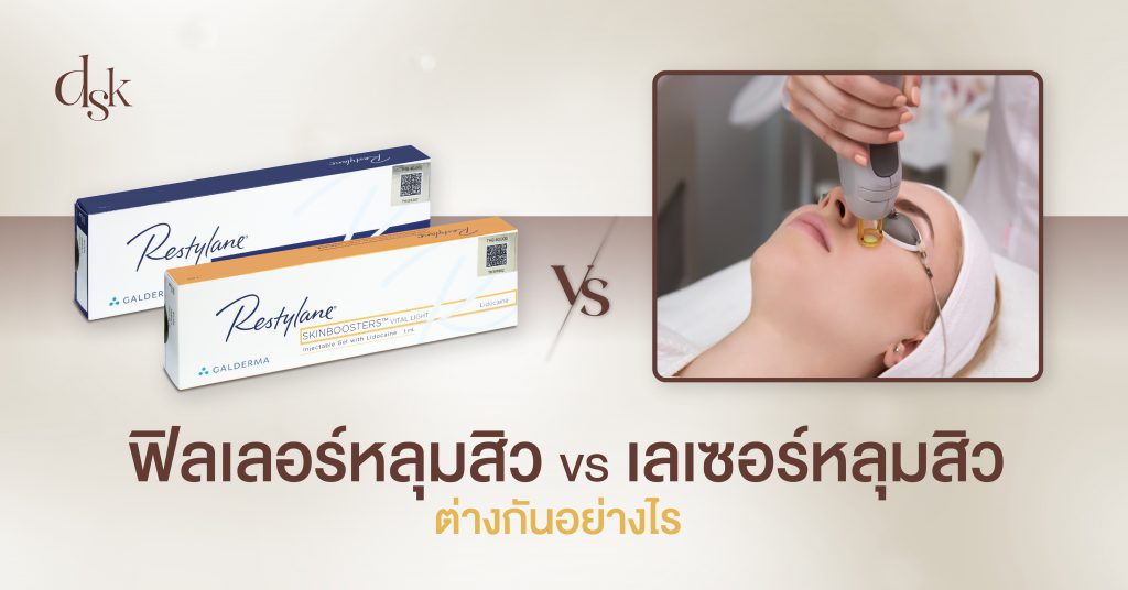 ฟิลเลอร์หลุมสิว VS เลเซอร์หลุมสิว ต่างกันอย่างไร