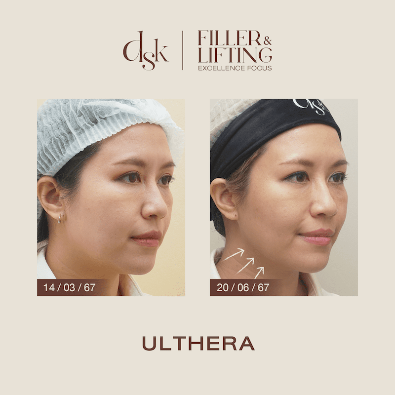 รีวิว อัลเทอร่า