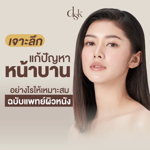 เจาะลึก แก้ปัญหาหน้าบานอย่างไรให้เหมาะสม ฉบับแพทย์ผิวหนัง