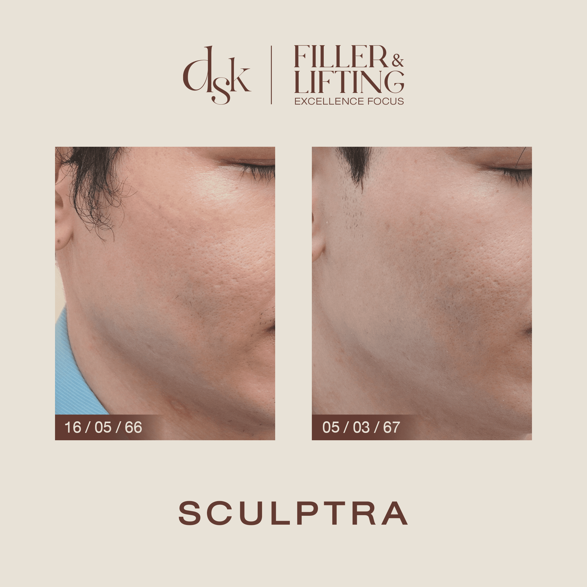 รีวิว Custom Skin Quality ที่ DSK Clinic