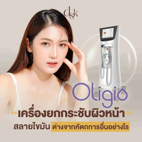 Oligio เครื่องยกกระชับผิวหน้า สลายไขมัน ผิวแน่นฟู ไม่เจ็บขณะทำ