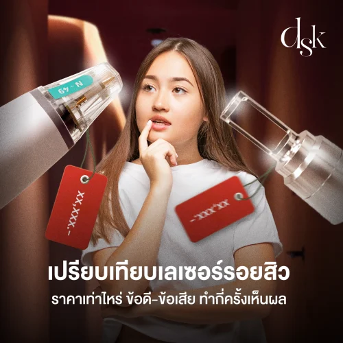 เปรียบเทียบเลเซอร์รอยสิว ราคาเท่าไหร่ ข้อดี-ข้อเสีย ทำกี่ครั้งเห็นผล