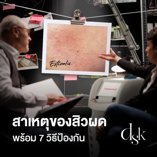 สิวผดคืออะไร เกิดจากสาเหตุใด มีวิธีรักษาสิวผดแบบเร่งด่วนไหม