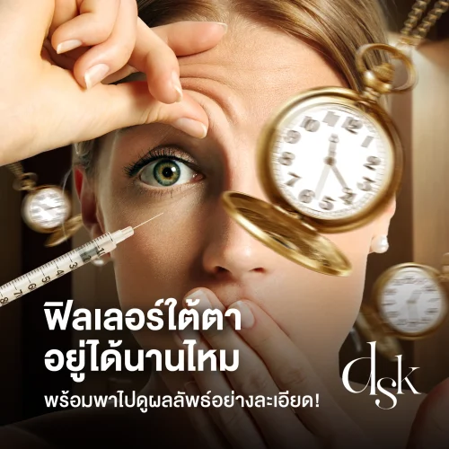 ฟิลเลอร์ใต้ตาอยู่ได้นานไหม พาไปดูผลลัพธ์ฟิลเลอร์ใต้ตาอย่างละเอียด!