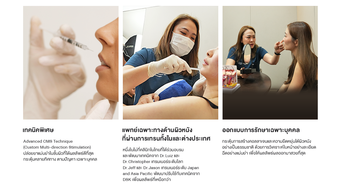 ทำไมต้อง sculptra