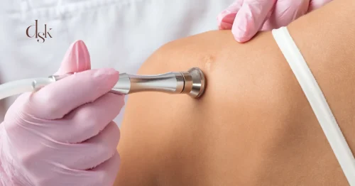 ตอบทุกคำถาม คีลอยด์คืออะไร? แผลคีลอยด์รักษาอย่างไร