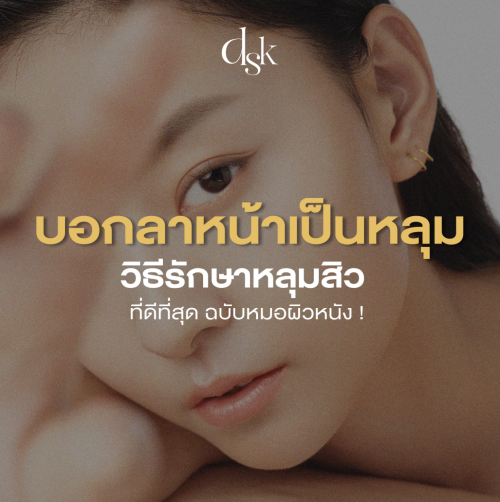 หลุมสิวเกิดจากอะไร พร้อมแนะนำวิธีรักษาหลุมสิวที่ดีที่สุด ฉบับหมอผิวหนัง!