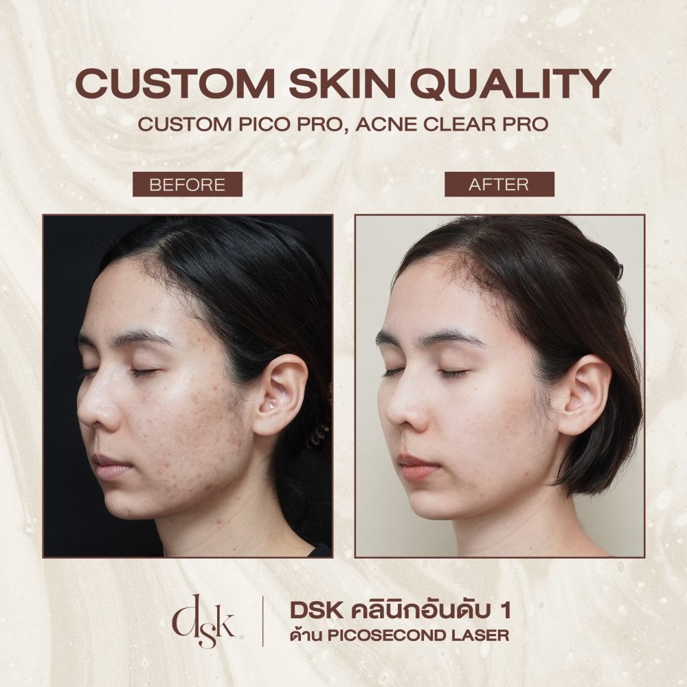 HN.15596_SKIN QUALITY