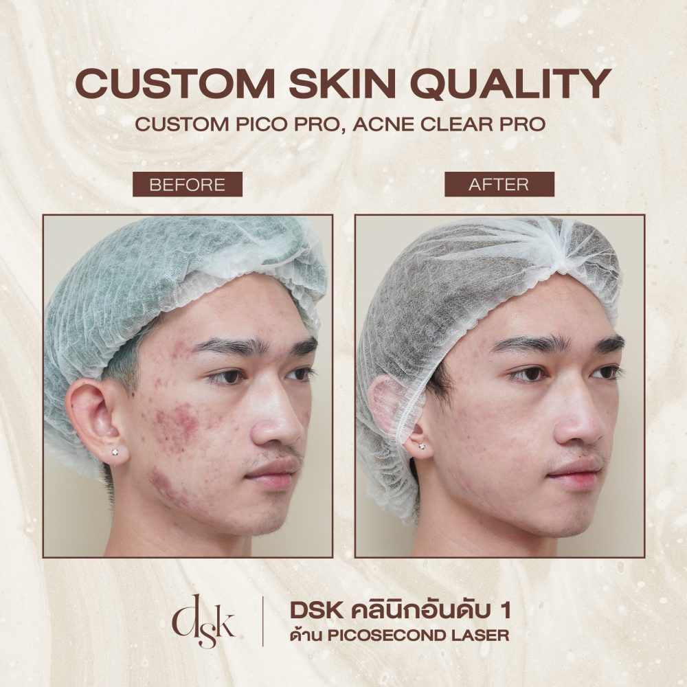 HN.17744_SKIN QUALITY