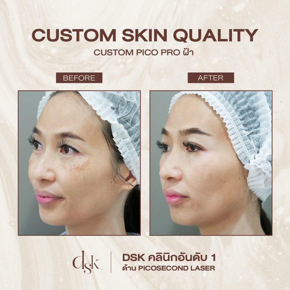 HN.2308_SKIN QUALITY