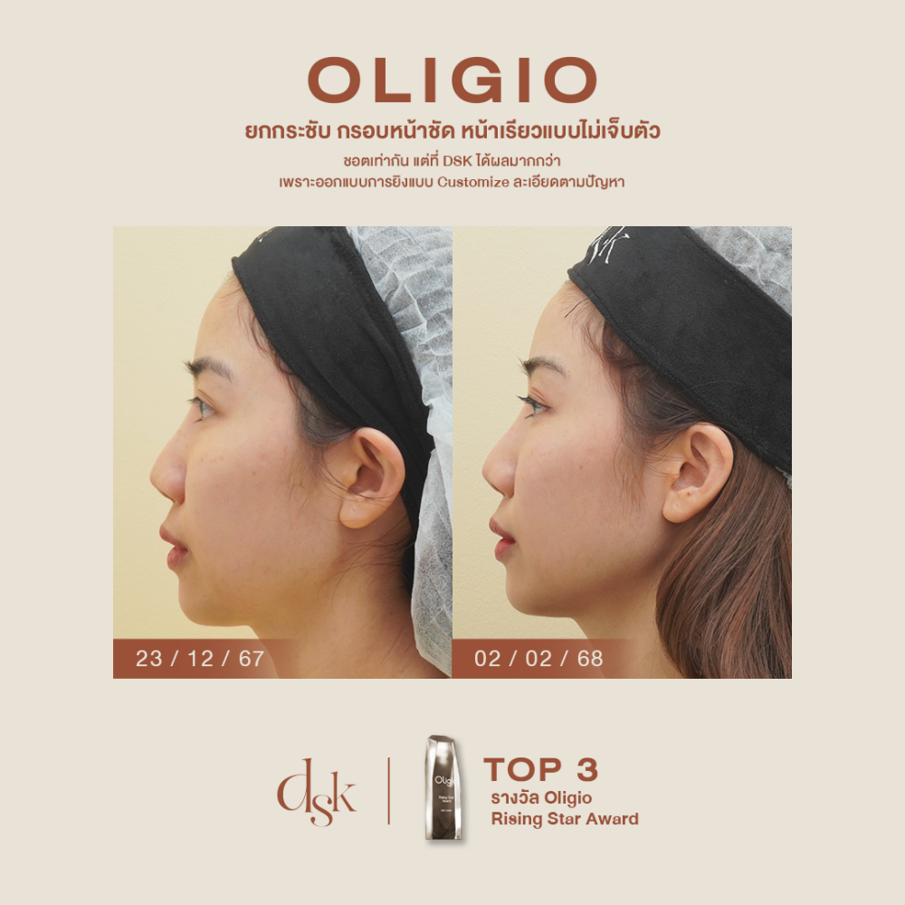 HN.B67-001624_oligio_dr.gift