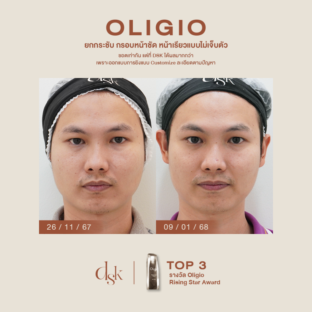 HN.P67-000246_oligio_dr.boong