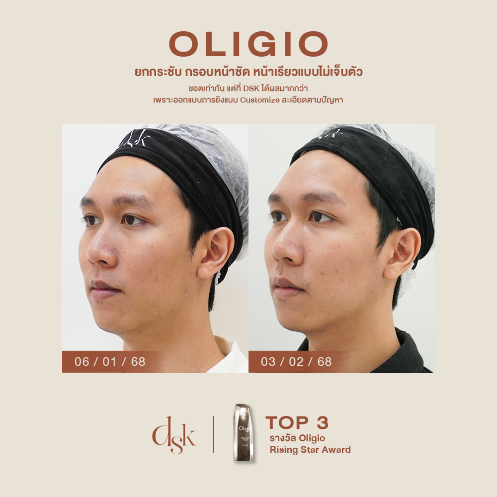 HN.P68-000383_Oligio_dr.sai