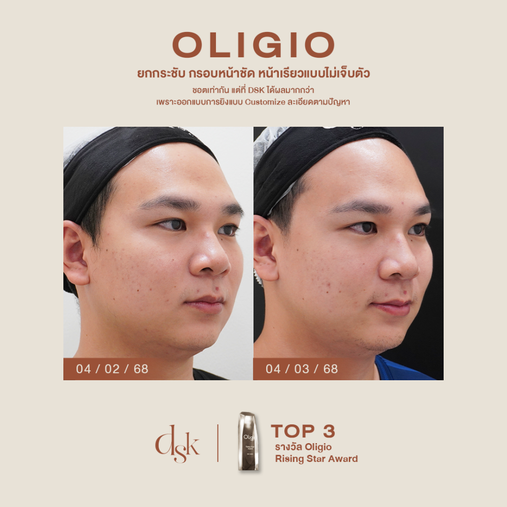 HN.P68-000440_Oligio_dr.kew