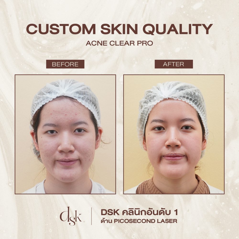 HN.S65-000228_SKIN QUALITY