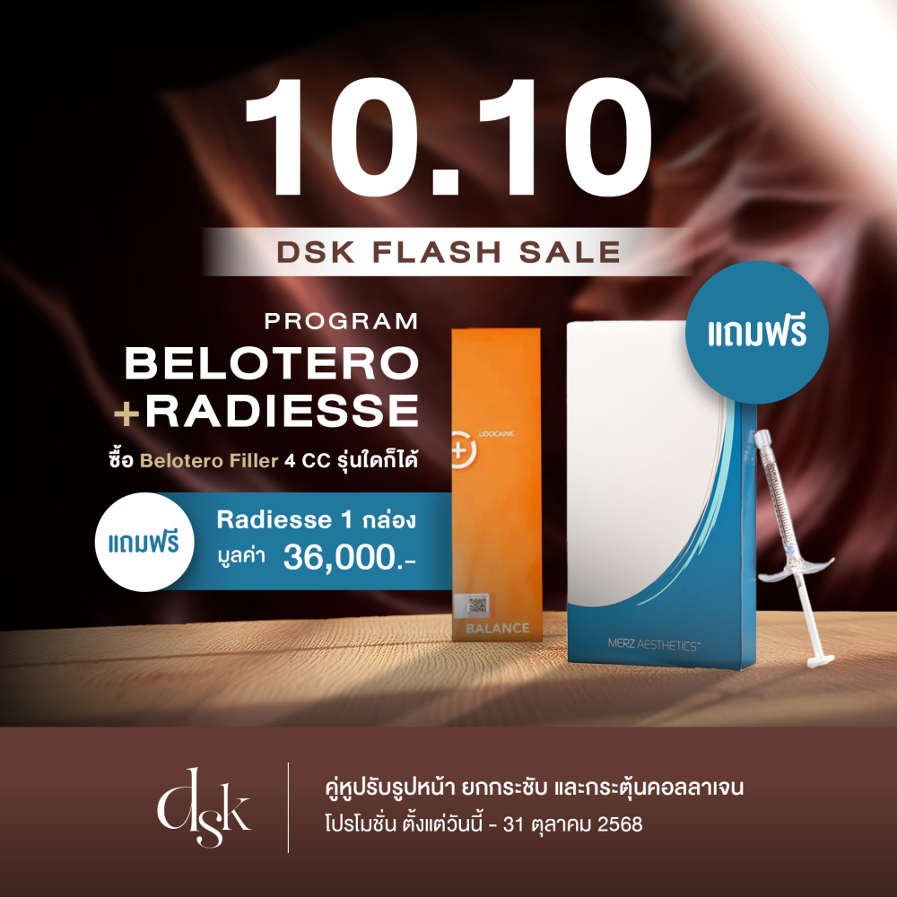 belotero+radiesse ad