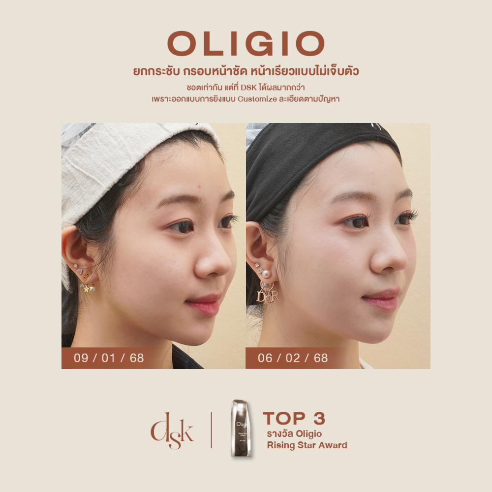 hn.S68-002510_oligio_dr.prince